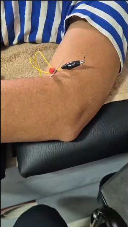 Video de Fisioterapia 1